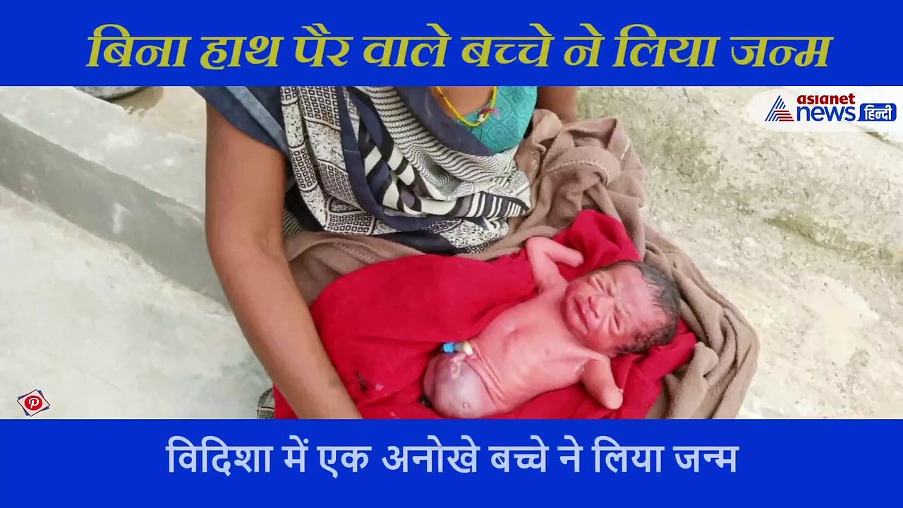 बच्चे के आधे हैं हाथ, पैर है ही नहीं, जन्म देकर दुखी हुई मां तो लोगों ने कहा ये चमत्कार है, देखें वीडियो