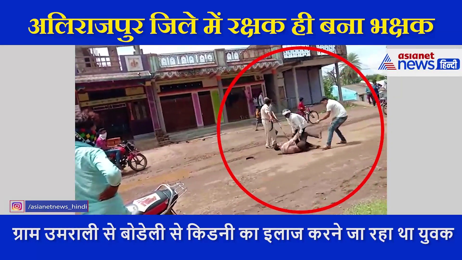 पुलिस की वर्दी में जानवर बन बैठा सिपाही, किडनी के बीमार युवक को मार-मार कर दिया अधमरा