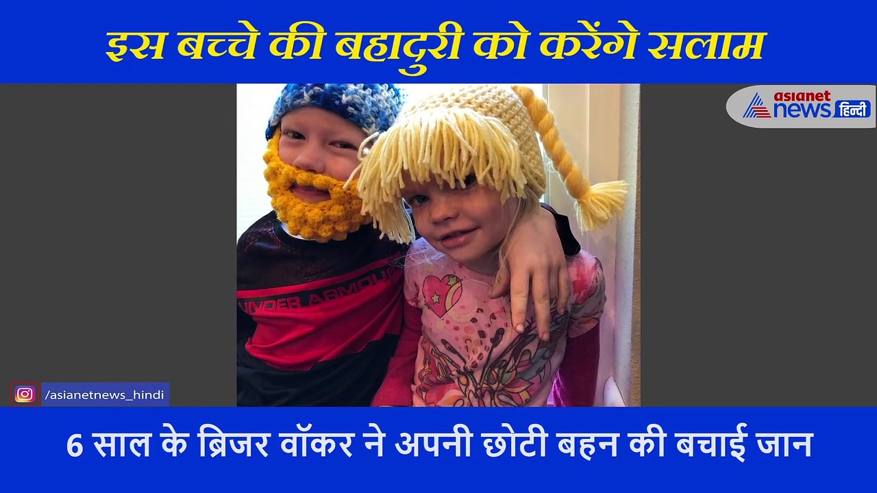 बहन को बचाया कुत्ते के हमले से, लेकिन खुद को लग गए 90 टांके