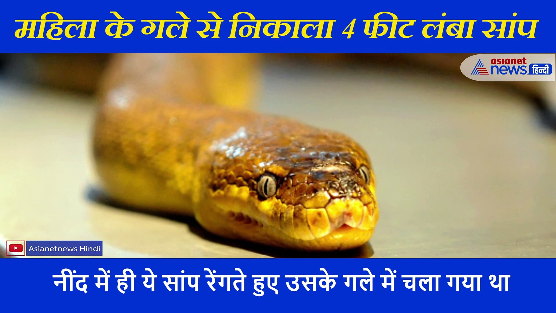 महिला के गले में घुस गया 4 फीट लंबा सांप; डॉक्टर्स रह गए दंग