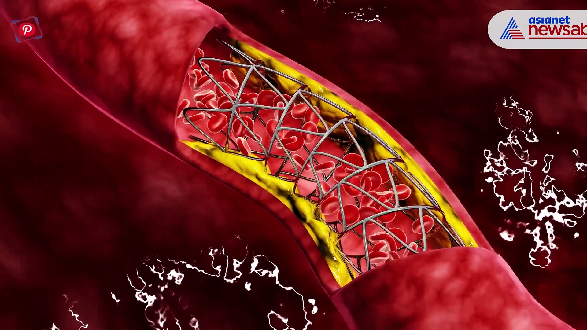 From avoiding sugar to managing stress: Ways to keep the heart healthy