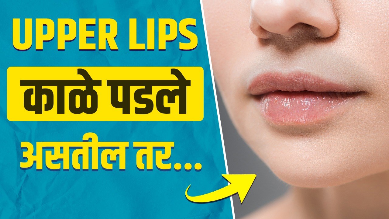 Upper lips खूप काळे पडलेत का? | How to Lighten Dark Upper Lip | Dark Upper Lips Treatment |