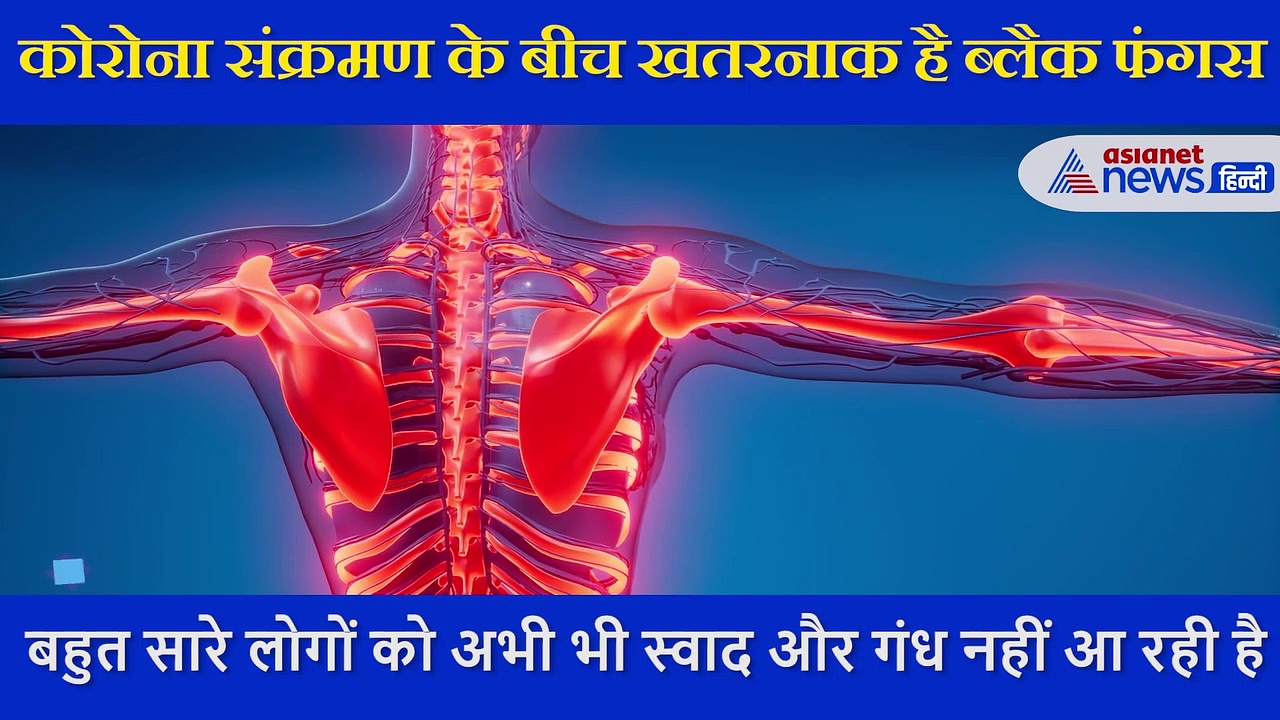 कोरोना संक्रमण के बीच संभालें अपनी आंखों की रोशनी, खतरनाक है ब्लैक फंगस