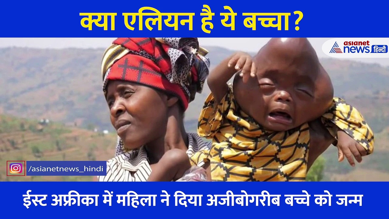 ऐसे बच्चे ने लिया जन्म कि गांव वालों ने कर दिया बहिष्कार, पिता ने सुनाया जान से मारने का फरमान