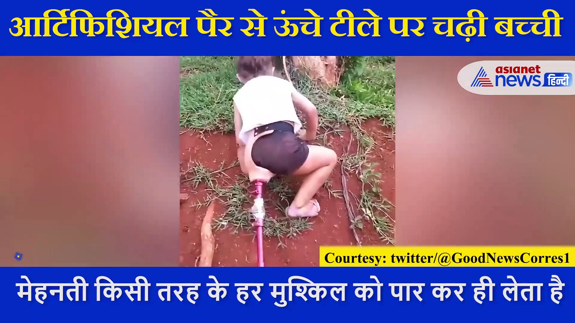मां ने बढ़ाया हौंसला, तो आर्टिफिशियल पैर  के सहारे ऊंचे टीले पर की चढ़ गई बच्ची, देखें Video