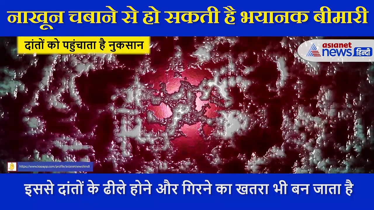 नाखून चबाने की है आदत तो आज ही छोड़ दें, एक्सपर्ट ने कहा हो सकती है ये बीमारियां
