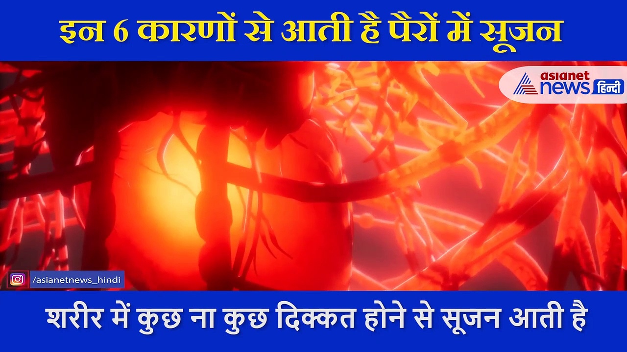इन 6 कारणों से आती है पैरों में सूजन, डॉक्टर ने बताया क्यों होती ये परेशानी