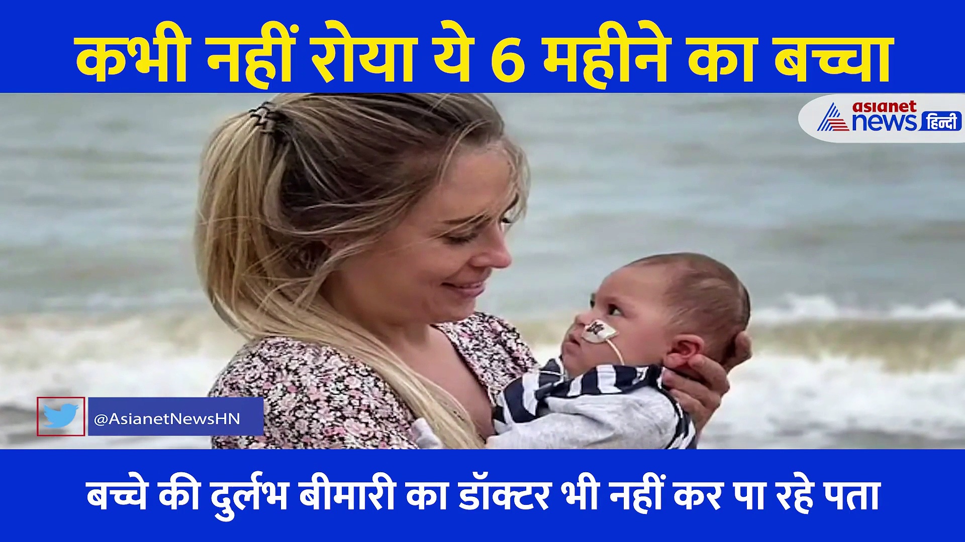 बच्चे की इस दुर्लभ बीमारी से डॉक्टर भी परेशान... कितना भी रुलाओ लेकिन कभी नहीं रोता ये 6 महीने का बच्चा