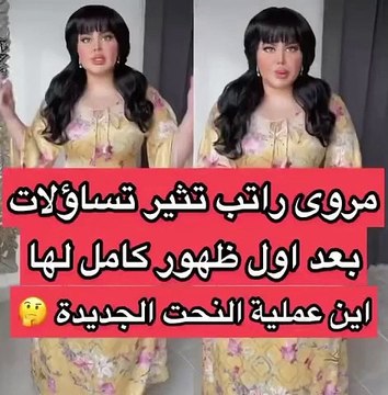 مروة راتب تثير جدل في أول ظهور لها بعد خضوعها للتجميل