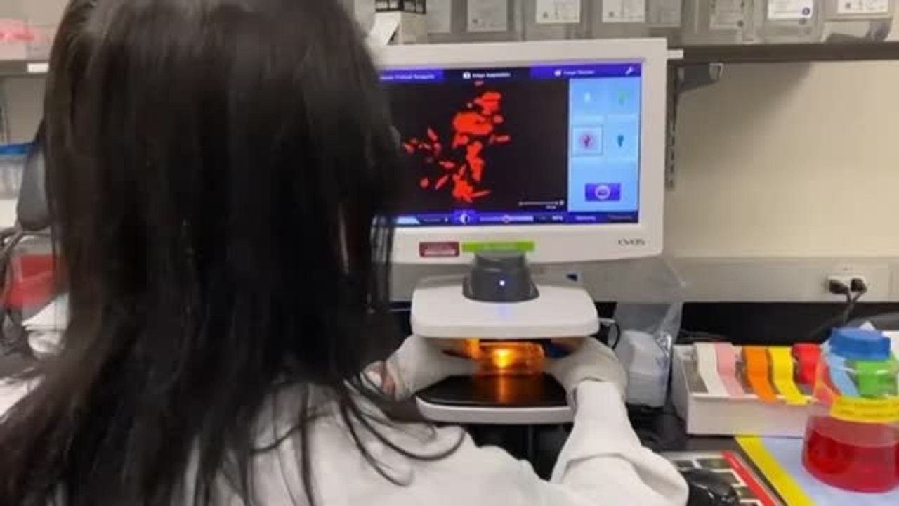 Decretada la alerta sanitaria tras detectarse 23 pacientes sospechosos de tener la viruela del mono