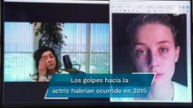 Muestran fotos de Heard golpeada: amiga de la actriz asegura que Depp es el culpable