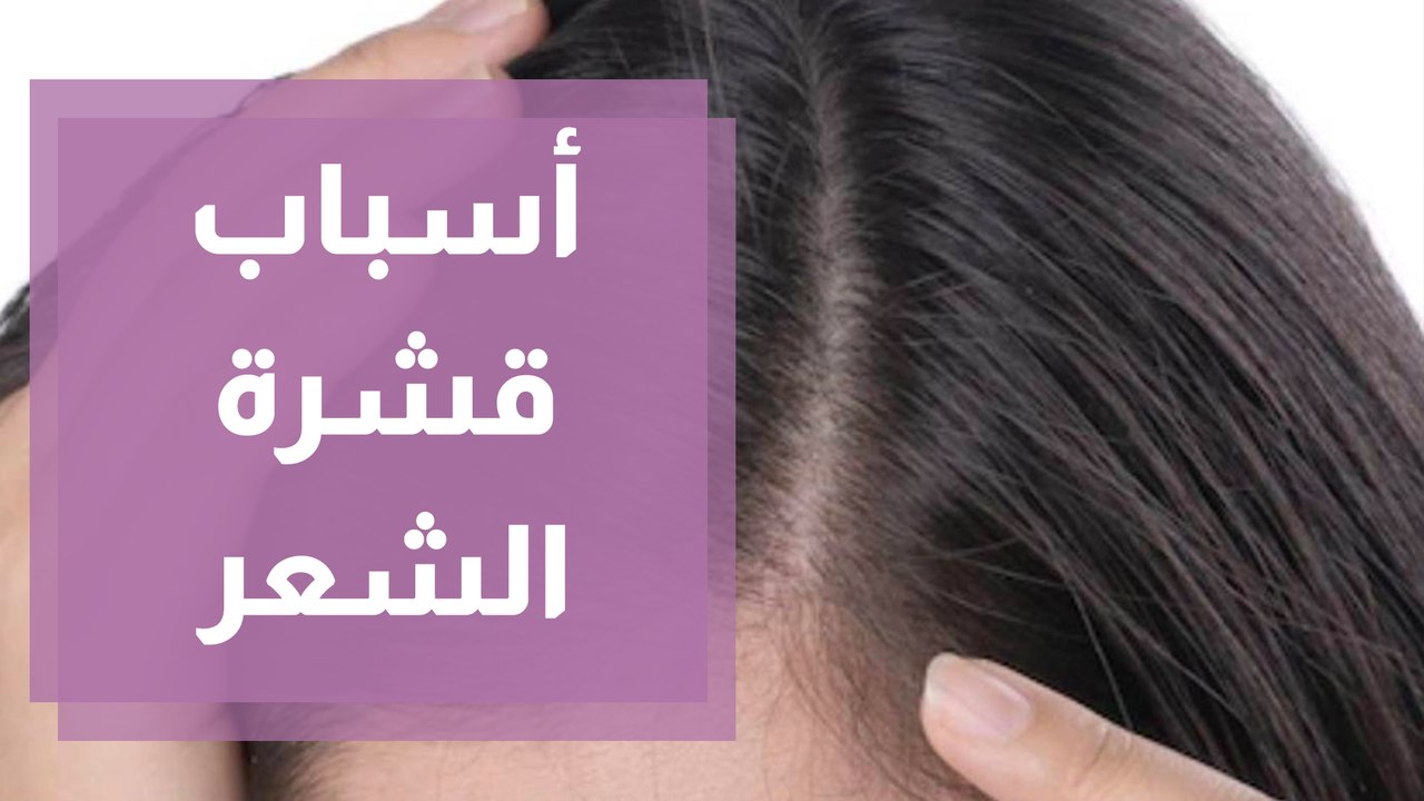 قشرة الشعر أسبابها وعلاجها