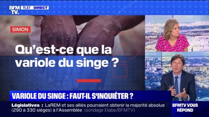 Qu'est-ce que la variole du singe ? BFMTV répond à vos questions