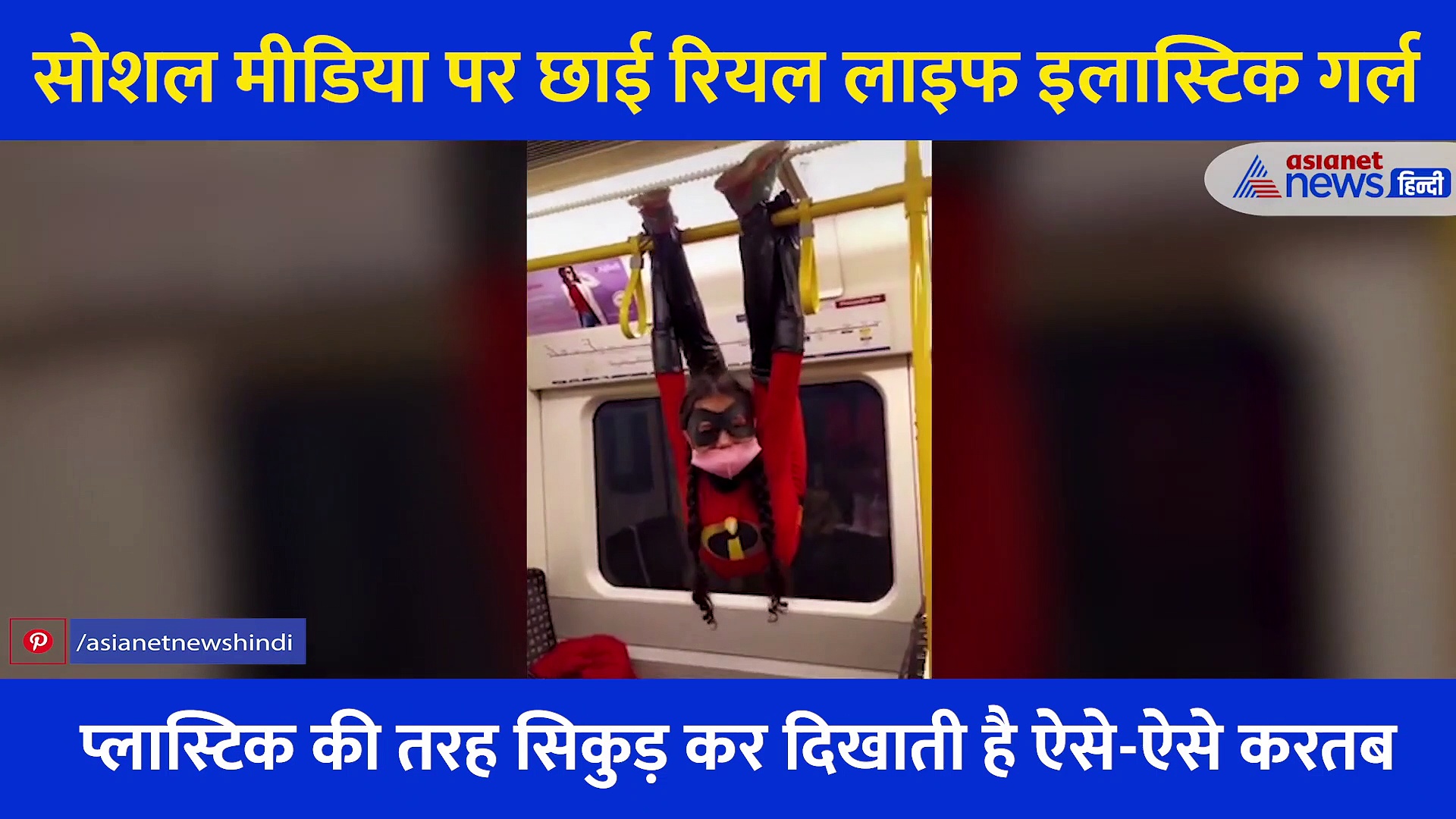 12 साल की बच्ची के शरीर में नहीं है कोई 'हड्डी', बैठे-बैठे सिकुड़कर बन जाती है प्लास्टिक की बॉल