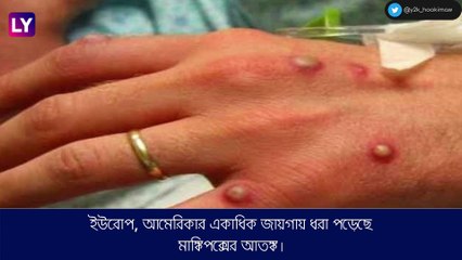 Monkeypox-এর হানাদারি, মহামারীর মধ্যে নয়া আতঙ্ক