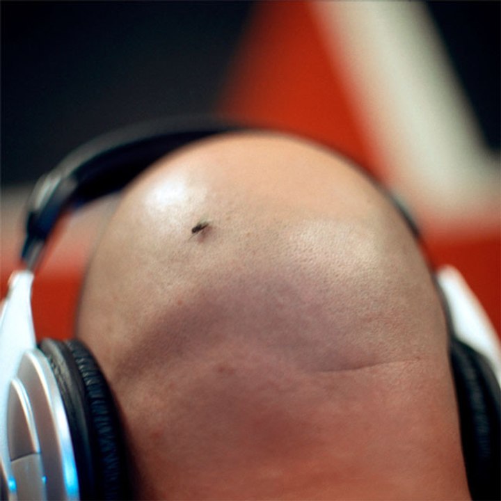 Einen Mann 'Glatzekopf' zu nennen, gilt als sexuelle Belästigung