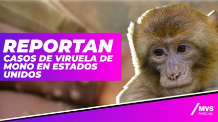 Viruela de los monos, el virus que llegó a EU