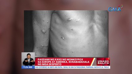 Pagdami ng kaso ng Monkeypox sa Europe at Amerika, ikinababahala ng mga eksperto