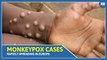 Monkeypox Cases Rapidly Spreading In Europe, North America: 7 countries affected so far