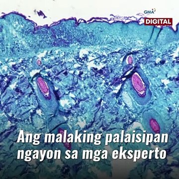 Monkeypox, may outbreak na sa ibang bansa | GMA News Feed