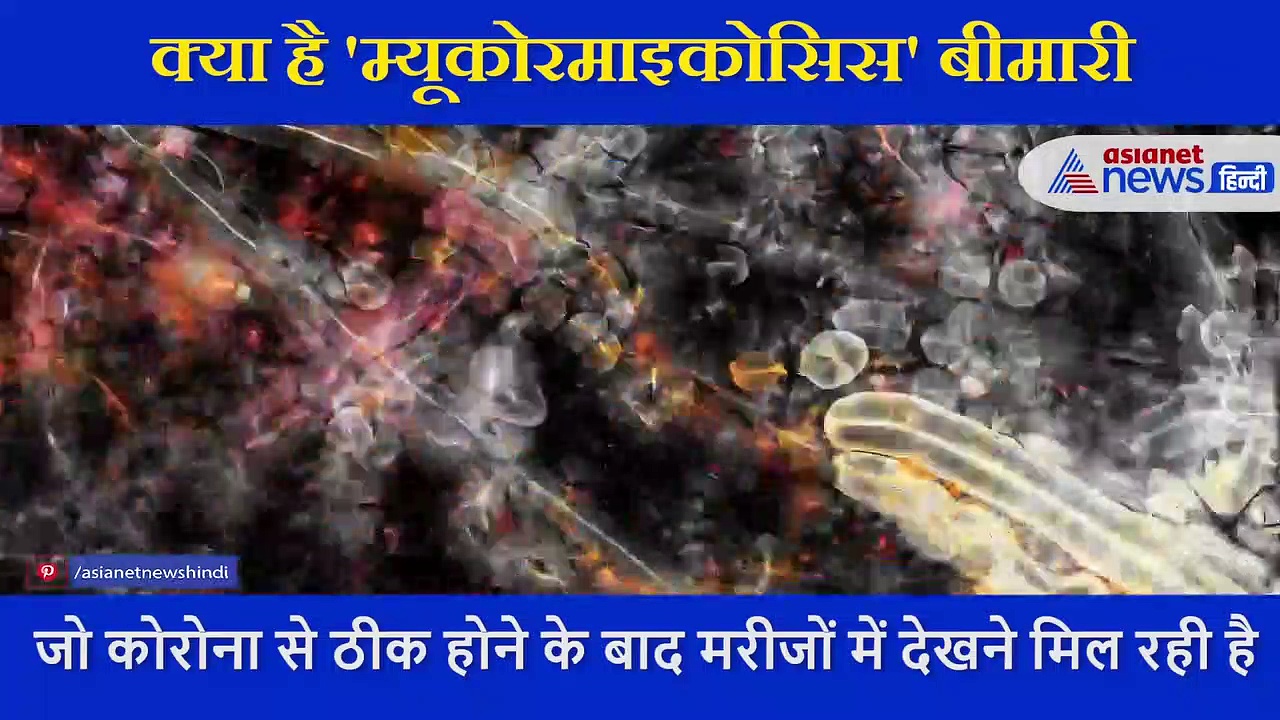 कोरोना वायरस  के बाद अब म्यूकोरमाइकोसिस ने दी दस्तक, डॉक्टर ने बताया कितनी जानलेवा है ये बीमारी