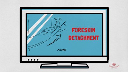 At what age should the foreskin separate from the glan