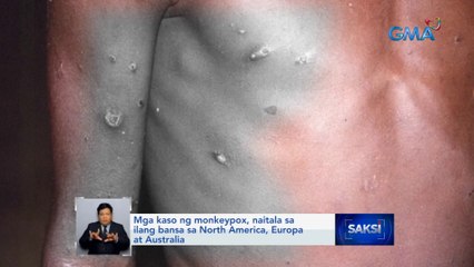 Mga kaso ng monkeypox, naitala sa ilang bansa sa North America, Europa at Australia | Saksi