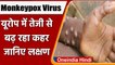Monkeypox Virus: मंकीपॉक्स हुआ खतरनाक, Europe में तेजी से पैर पसार रहा, जानिए लक्षण | वनइंडिया हिंदी