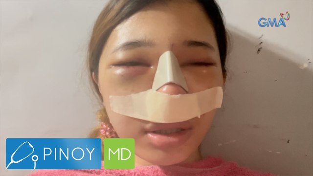 Ilong ng dalaga matapos magparetoke, tinubuan ng bukol at na-impeksyon. Ano ang dahilan? | Pinoy MD