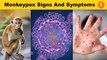 Monkeypox என்றால் என்ன? |  Monkeypox Virus | Monkeypox Signs And Symptoms | Oneindia Tamil