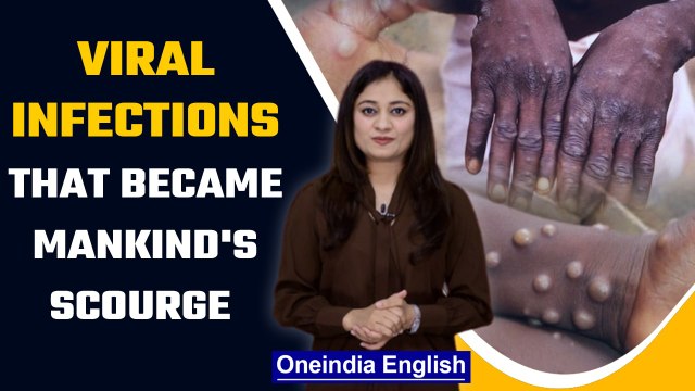 Monkeypox cases outbreaks in 11 countries, Know some of the deadliest diseases | Oneindia News