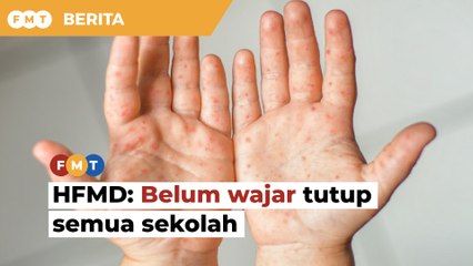 HFMD: Belum wajar tutup semua sekolah walau kes Selangor tinggi, kata MB