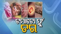 All you need to know about Monkeypox & Tomato Flu - OTV Special Report