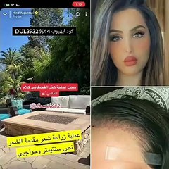 عمليات تجميل هند القحطاني لزراعة الشعر