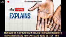 Monkeypox is spreading in the UK through community transmission and new cases are being detect - 1br