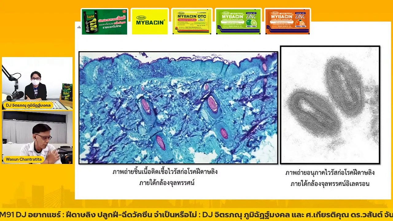 ฝีดาษลิง ปลูกฝี-ฉีดวัคซีน จำเป็นหรือไม่ : DJ อยากแชร์ : 28 พฤษภาคม 2565