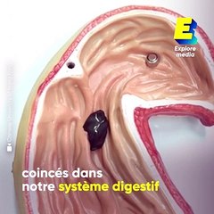 Une pâte magnétique pour récupérer les objets avalés par accident