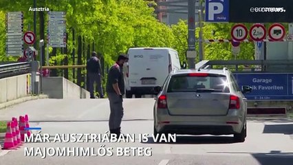 Már Bécsben is azonosítottak egy majomhimlős beteget