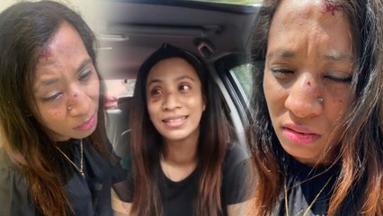 Ngeri! Biji mata dikorek penjenayah, wanita ini menggigil cerita detik menakutkan