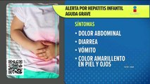 UNAM pide estar atentos a síntomas de hepatitis infantil aguda