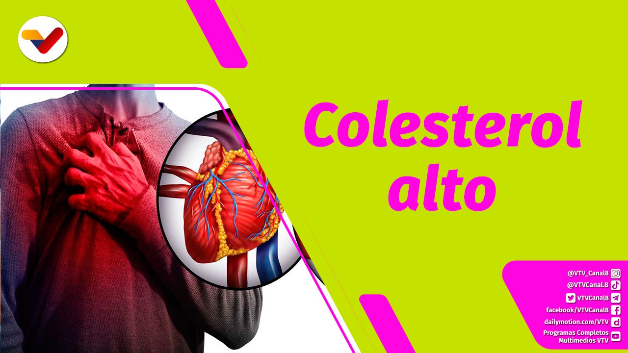 Buena Vibra | ¿Cómo evitar un infarto cuidando los niveles de colesterol alto?