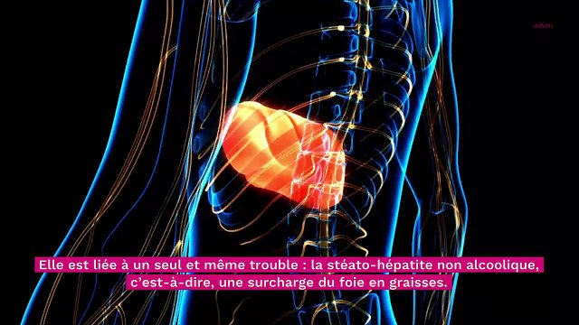 NASH : la maladie du soda, quels sont les symptômes ?