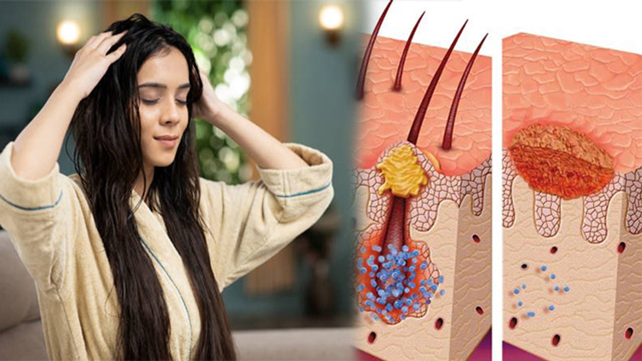 रात को बालों में तेल लगाना चाहिए या नहीं | रात को बालों में तेल लगाने के नुकसान | Boldsky