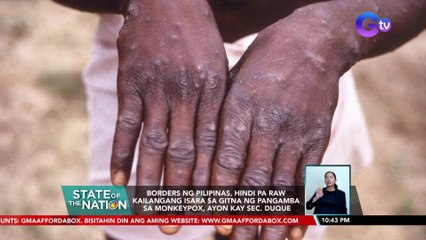 Borders ng Pilipinas, hindi pa raw kailangang isara sa gitna ng pangamba sa Monkeypox, ayon kay Sec. Duque | SONA