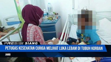 Bocah 8 Tahun Disiksa Ibu Tiri Selama 1 Tahun