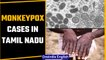 Tamil Nadu reports suspected cases of Monkeypox | Oneindia News