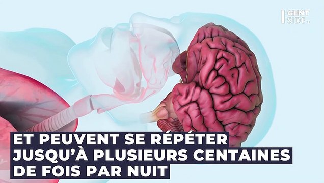 Apnée du sommeil : traitement, symptômes, appareil, de quoi s’agit-il ?