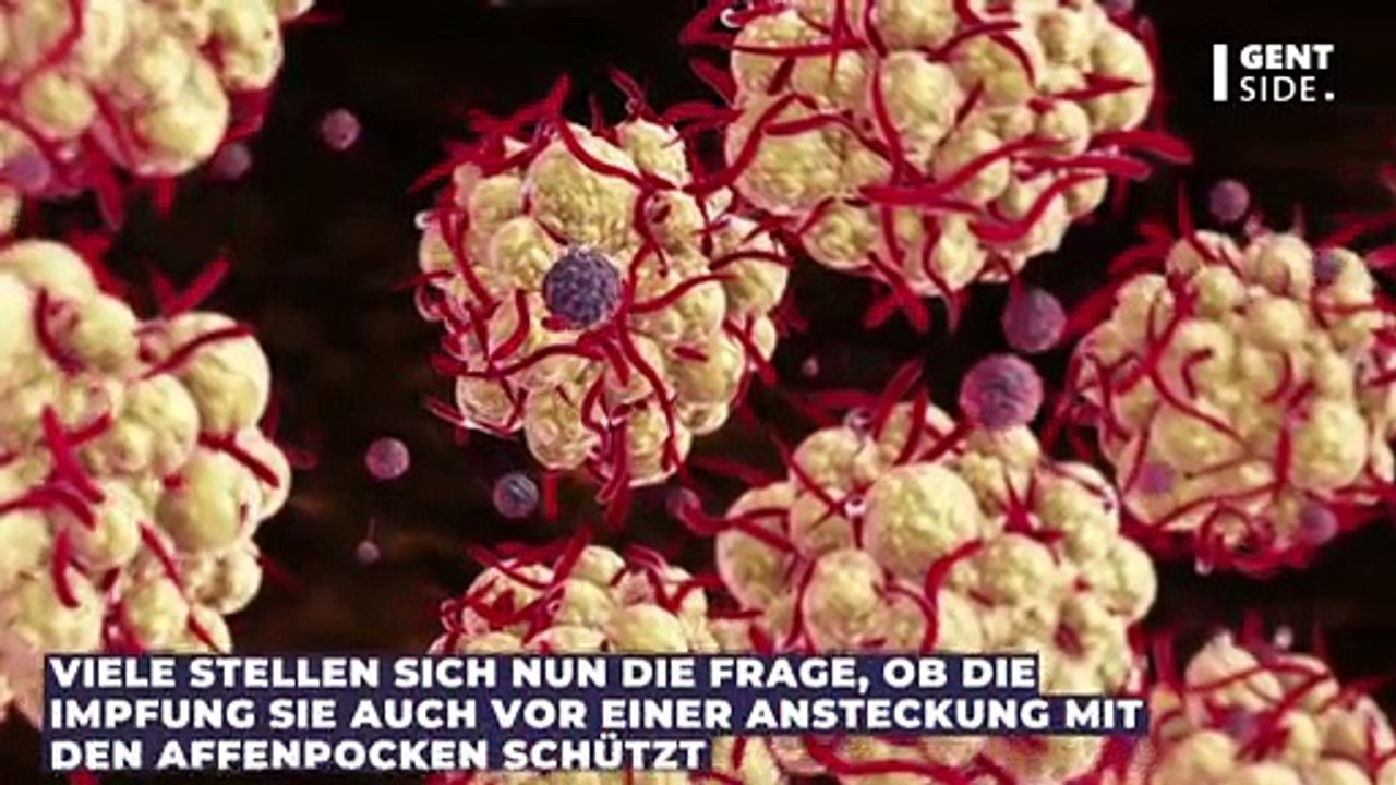 Affenpocken: Bietet die klassische Pockenimpfung Schutz vor einer Ansteckung?