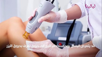 حروق الليزر وطرق علاجها