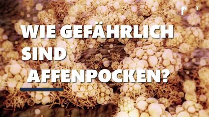 Wie gefährlich sind Affenpocken?